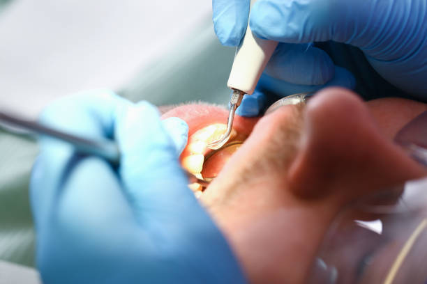 Best Walk-In Emergency Dental Services in Vanceburg, KY